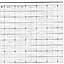 ABB Kent-Taylor 82S1000  Strip Chart Roll